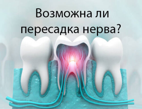 Возможна ли пересадка нерва из здорового зуба, в зуб в котором нет нерва?